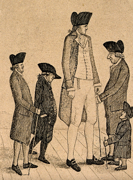 John Kay's depiction of  Charles Byrne towering over the extra short George Cranstoun and three contemporaries of more conventional height.